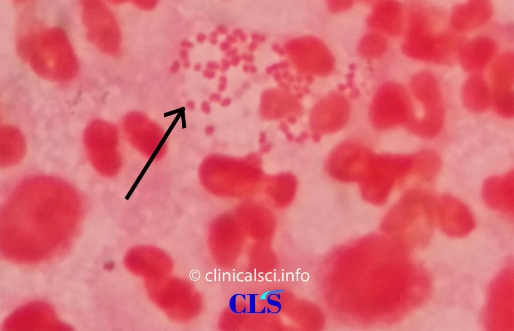 gonorrhoeae gram stain