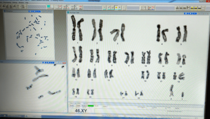 chromosome-nomenclature-and-g-banding-clinical-laboratory-science