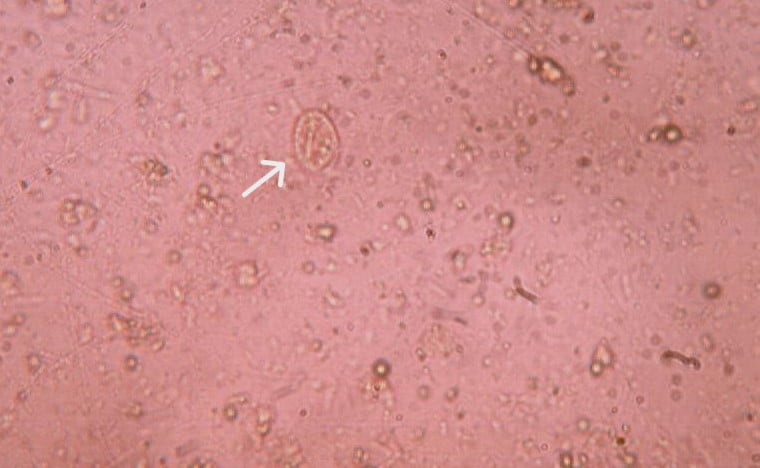 Cyst of Giardia lamblia microscopic image x40 wet preparation