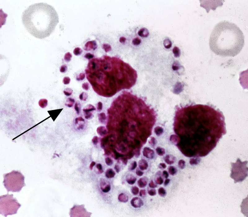 Laboratory Diagnosis of Leishmaniasis
