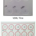 VDRL and RPR antibody titers used to monitor syphilis treatment response