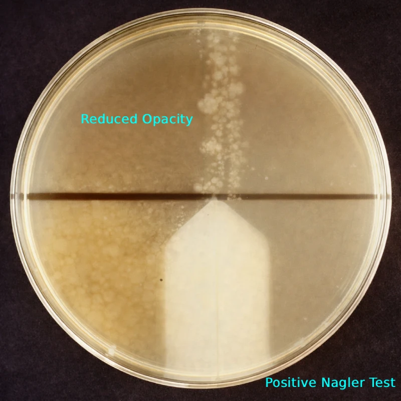 Nagler Reaction Test: Principle, Procedure & Interpretation
